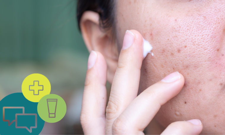 Acne and spots – Putting the squeeze on marketers to deep clean skin product ads